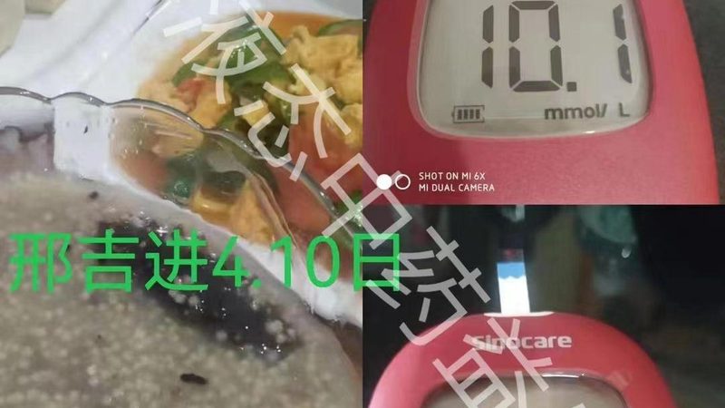 医院推荐维生素D3钙片：成分解析与选购要点